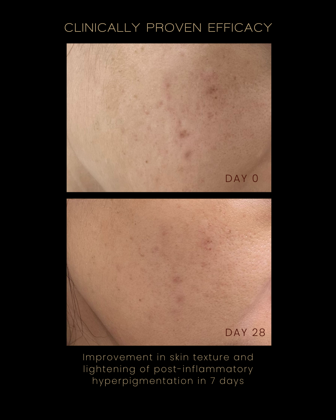 Mini Flawless Serum