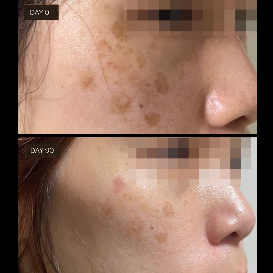 Mini Flawless Serum