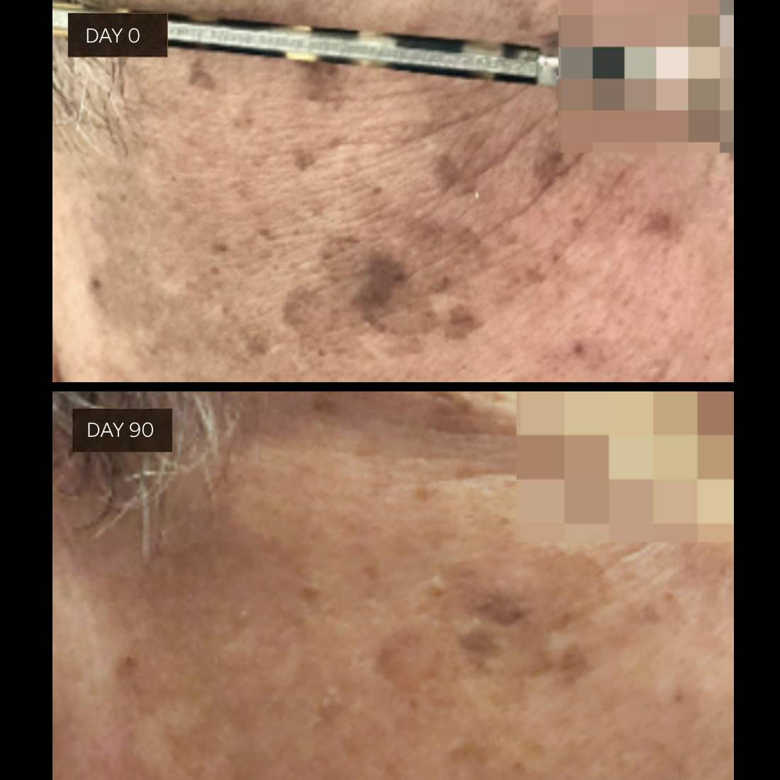 Mini Flawless Serum