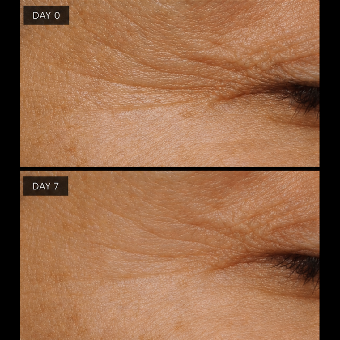 Ageless Serum