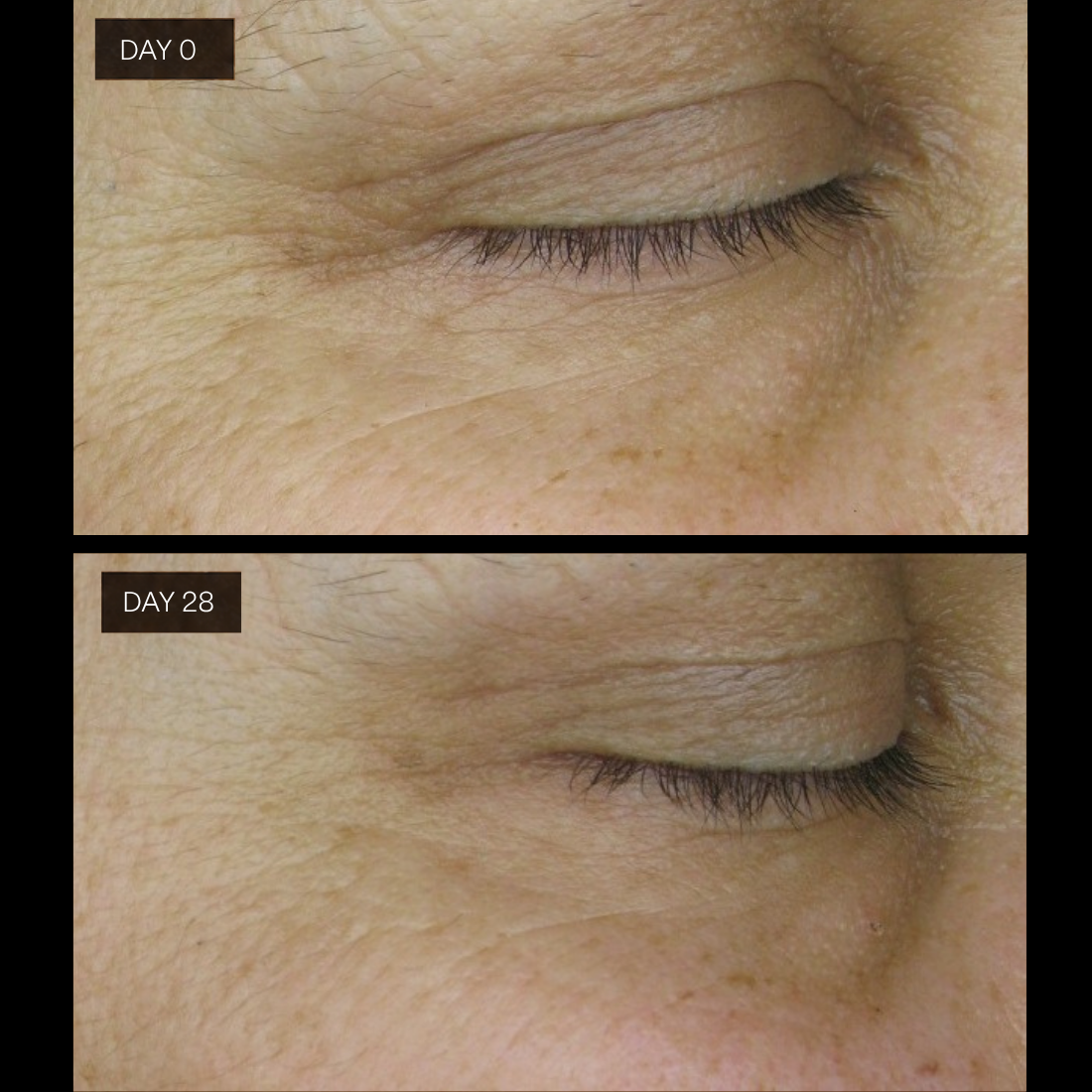 Ageless Serum